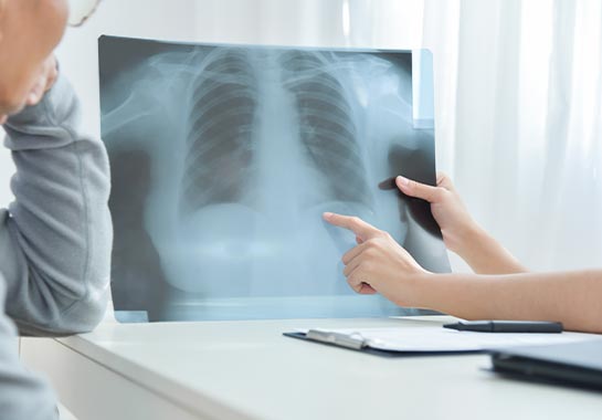 Médico mostrando radiografia do pulmão ao paciente - Clínica do Pulmão